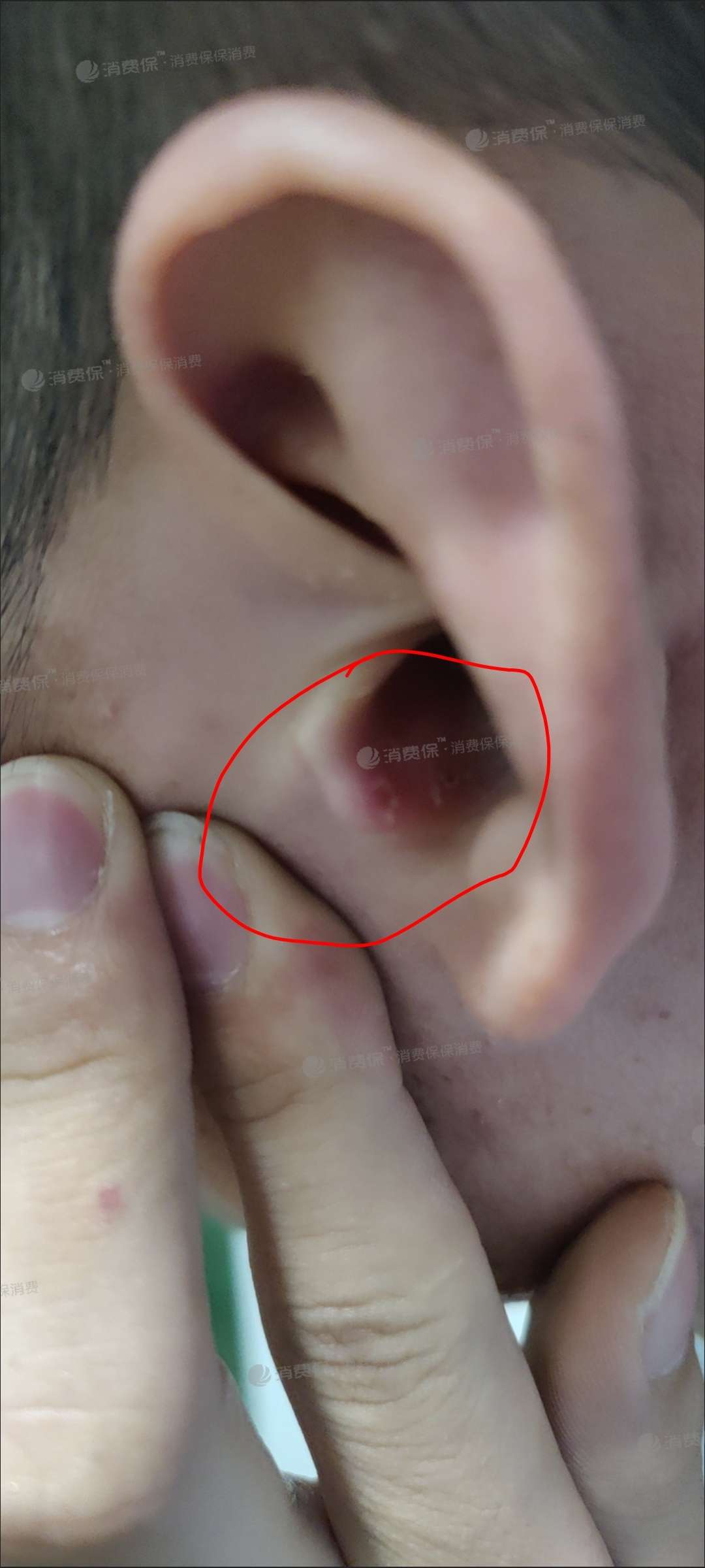 拼多多购买耳机漏电存在危险