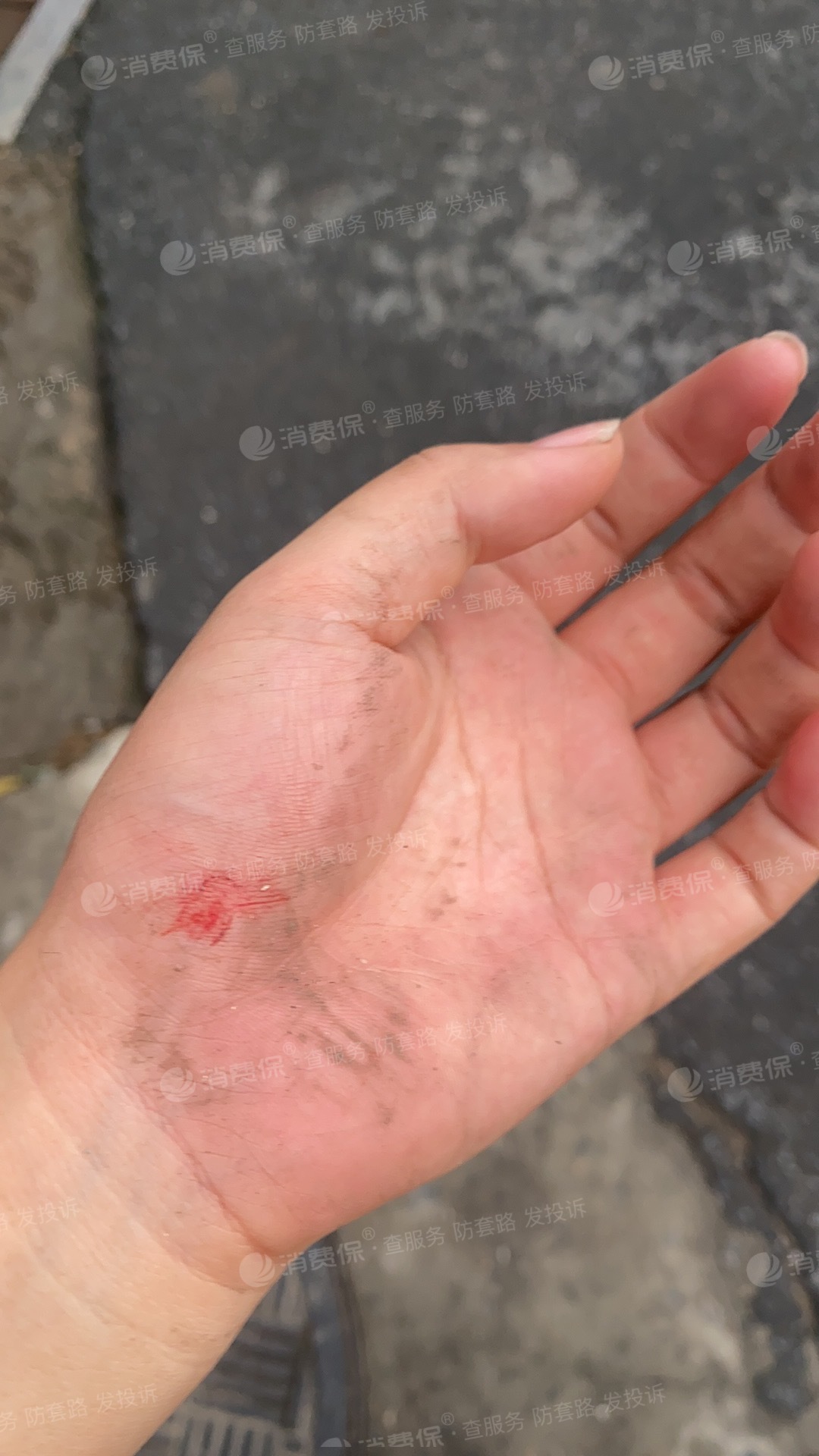 车,正常骑行过程中,突然断电,导致我整个人从车上摔了下来,多出擦伤